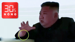 Bản tin 30s Nóng: Vết đỏ trên tay ông Kim Jong Un và sự tò mò của truyền thông thế giới