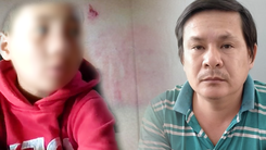Video: Bắt người cha đánh tét đầu, cấu rách tai con trai 9 tuổi ở Gia Lai