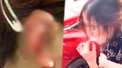 Video: Người phụ nữ cắn đứt tai cô gái vì ghen tuông ở Thanh Hóa bị khởi tố