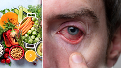 Người bị đau mắt đỏ thì nên kiêng ăn và uống món gì?
