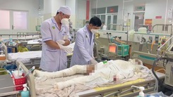 Vụ đánh ghen 7 người bị bỏng ở Đồng Nai: Thêm một bệnh nhi qua đời