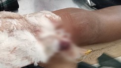 Bị nhiễm trùng vì bó nguyên con gà vào chân để chữa gãy xương đùi