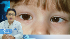 Điều trị lé mắt cho trẻ bằng đông y có hiệu quả?