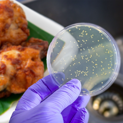 Podcast: Ba loại vi khuẩn gây ngộ độc cho học sinh iSchool Nha Trang độc đến mức nào?