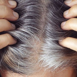 Podcast: Đã tìm ra nguyên nhân, sẽ có cách ngăn ngừa tóc bạc?