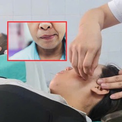 Nguyên nhân gây liệt dây thần kinh số 7 và cách phòng trị, có thể bạn chưa biết