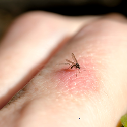 Không phải nhóm máu O hay da mịn màng, đây mới là thứ khiến muỗi đốt bạn!
