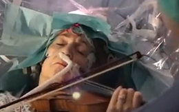 Bệnh nhân chơi violin trong lúc đang phẫu thuật não