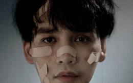Nguyễn Trần Trung Quân tung poster với khuôn mặt đầy vết thương