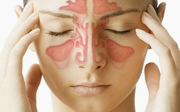 Hắt hơi mạnh thì bị chảy máu ở cổ họng là bệnh gì?