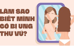 Làm sao biết mình có bị ung thư vú gọi tên?