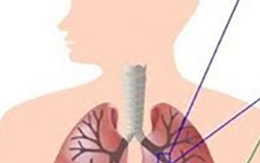 Bỏ thuốc lá để không gia nhập vào số 10 người chết/giây vì COPD!