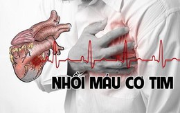 Đau tim không có... đau tim, cấp cứu sao kịp?