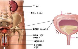 Không vô nhà vệ sinh kịp thì són tiểu là bệnh gì?