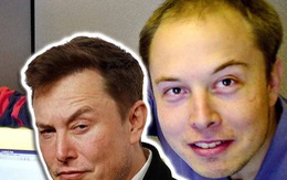 Tại sao Elon Musk trị được chứng hói đầu?