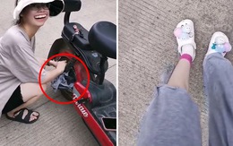 Cô gái bị bánh xe đạp điện xé rách quần