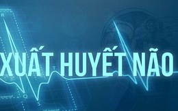 Xuất huyết não khởi điểm từ đâu?