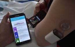 Dùng smart-phone hỗ trợ tuỵ nhân tạo điều trị bệnh tiểu đường tuýp 1