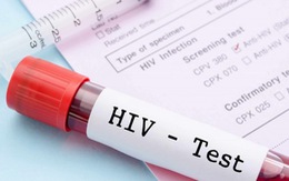 Xét nghiệm HIV sớm: Tiền đề để đạt mục tiêu 90-90-90