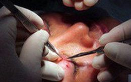 Sở Y tế Hà Nội vào cuộc vụ ‘cắt mí mắt tại spa’