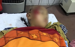 Sập lan can trường tiểu học, 11 học sinh bị thương