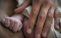 Pháp điều tra hàng chục trường hợp trẻ sơ sinh không có tay