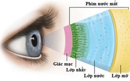 Khô mắt - nguyên nhân và điều trị