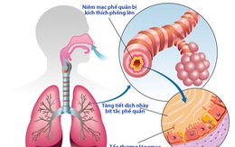 Viêm phế quản cấp ở người lớn