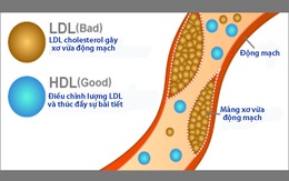 Phân biệt mỡ máu 'tốt' và 'xấu'