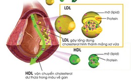 Các loại thành phần chính của lipid máu
