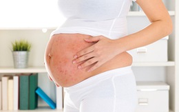 Bệnh vẩy nến có ảnh hưởng tới thai kỳ không?