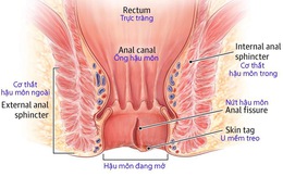 Đau hậu môn và nhiễm trùng hậu môn