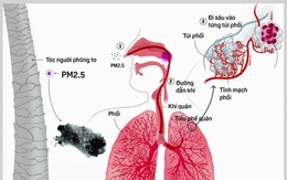 Tác hại khôn lường từ ô nhiễm không khí đến sức khỏe