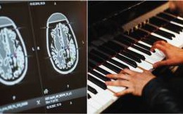 Kỳ lạ nghệ sĩ chơi piano trong khi được phẫu thuật não