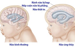 Não úng thủy