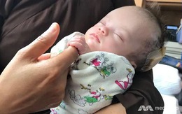 Em bé bị treo trên cây ở Việt Nam hồi phục kỳ diệu ở Bệnh viện Singapore