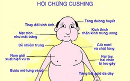 Hội chứng Cushing và bệnh Cushing