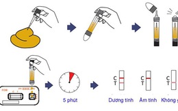 Xét nghiệm máu ẩn trong phân