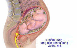 Viêm màng ối và thai kỳ