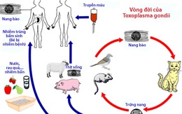 Bệnh nhiễm ký sinh trùng Toxoplasma