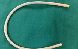 Clip lấy ống nhựa cứng dài 30cm trong khung chậu nữ bệnh nhân
