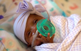 Em bé nhỏ nhất thế giới nặng 243 gram sống sót kỳ diệu