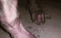 Chân 'người sói' hóa ra chỉ là chân… chó ghẻ