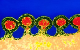 Các nhà khoa học Trung Quốc chỉnh sửa gen chữa HIV, ung thư máu