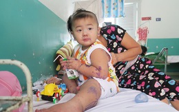 Gia tăng trẻ bị bệnh tay chân miệng tại TP. Hồ Chí Minh