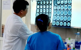 Lần đầu tiên ở Việt Nam có bệnh nhân xuất huyết não do... ngộ độc ma túy đá