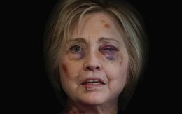 Hết hồn với ảnh bà Hillary Clinton bầm mặt như bị chồng đánh