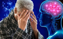 Một đêm mất ngủ làm tăng nguy cơ bệnh Alzheimer lên 17%