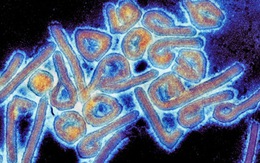 Phát hiện virus hiếm lây truyền từ người sang người tại Bolivia