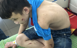 Vụ bé trai bị bạo hành: Hàng xóm có nghi ngờ nhưng không ai để ý